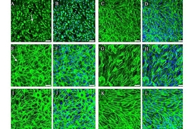 blog/from-hagfish-to-membrane-modeling-age-related-macular-degeneration.htm