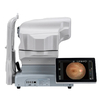 RetiCam 3100 Fundus Camera Ophthalmic Equipment Manufacturer Non-mydriatic Digital Eye Fundus Camera Ophthalmoloy