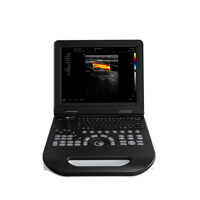 Notebook Color Doppler MDW-XFE30（convex probe）